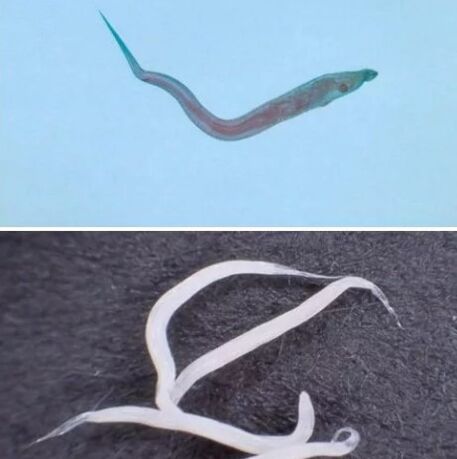 Types of parasites in the human body