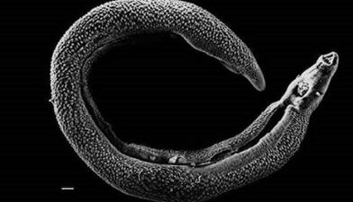 What parasites can live in a person's liver